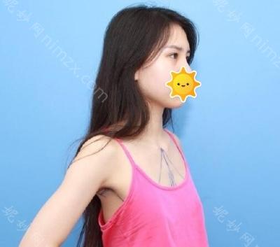 昆明梦想医疗美容整形医院张燕雄怎么样