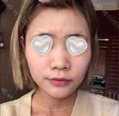 云南铜雀台美容医院台马先文医生怎么样