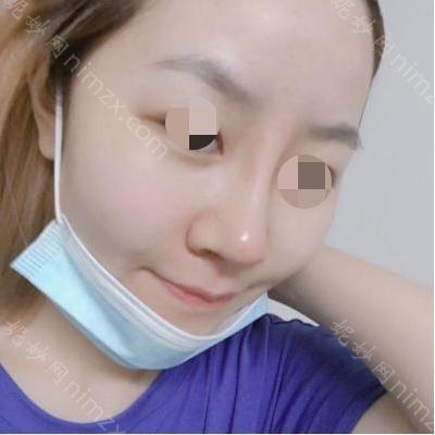 云南铜雀台美容医院台宋居财医生怎么样
