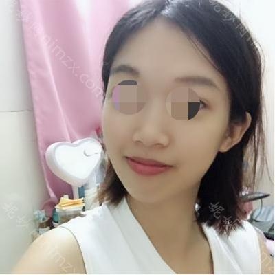 云南铜雀台整形美容医院台邱成医生怎么样