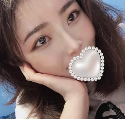 昆明梦想医疗美容整形医院张燕雄做的鼻子怎么样