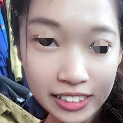 云南铜雀台整形美容医院台邱成医生怎么样