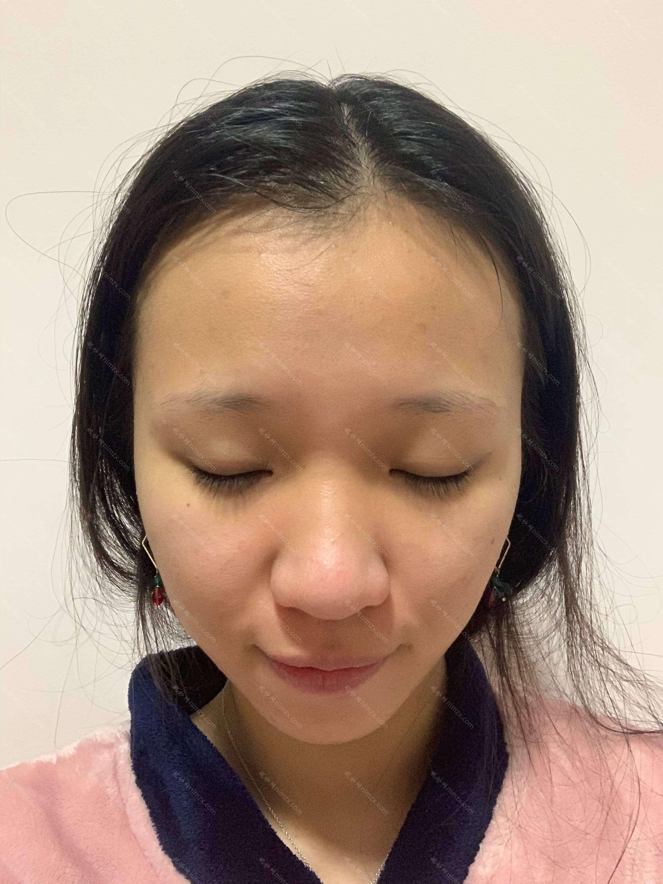 天津哪家医院做磨颧骨效果好？这几家预约量高口碑好_价格透明！