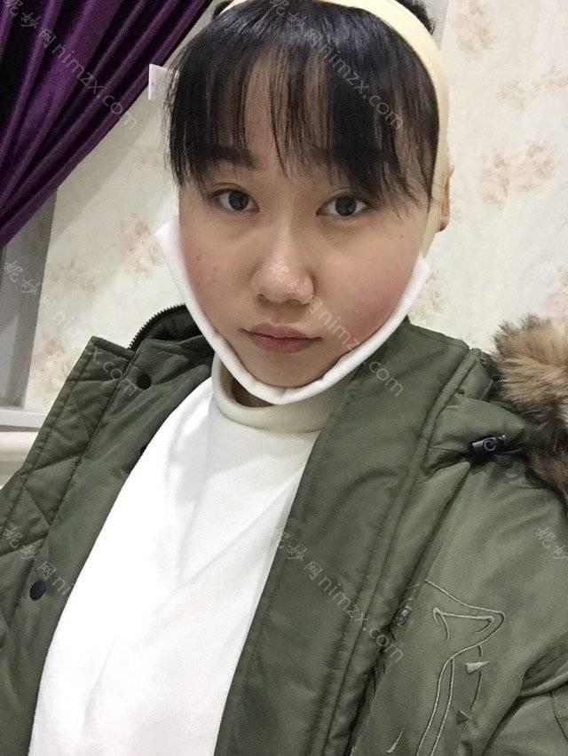 天津哪家医院做面部不对称效果比价好？汇总一份口碑医院排行榜前五点评!价格表全新查询！