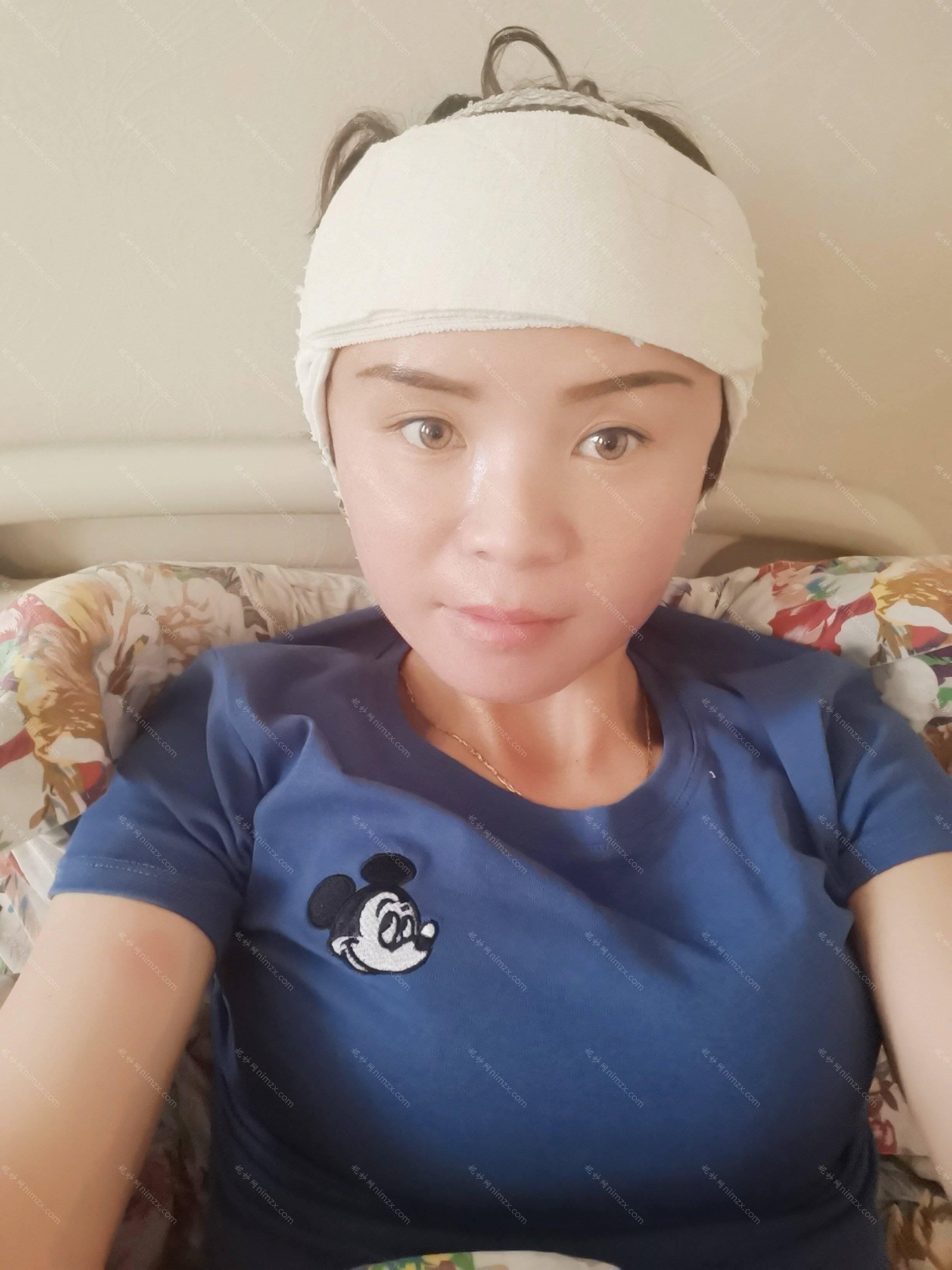 天津哪家医院做硅胶丰太阳穴比较靠谱？中爱铭医、健丽、瑷珊韩铭等实力在线比较!！