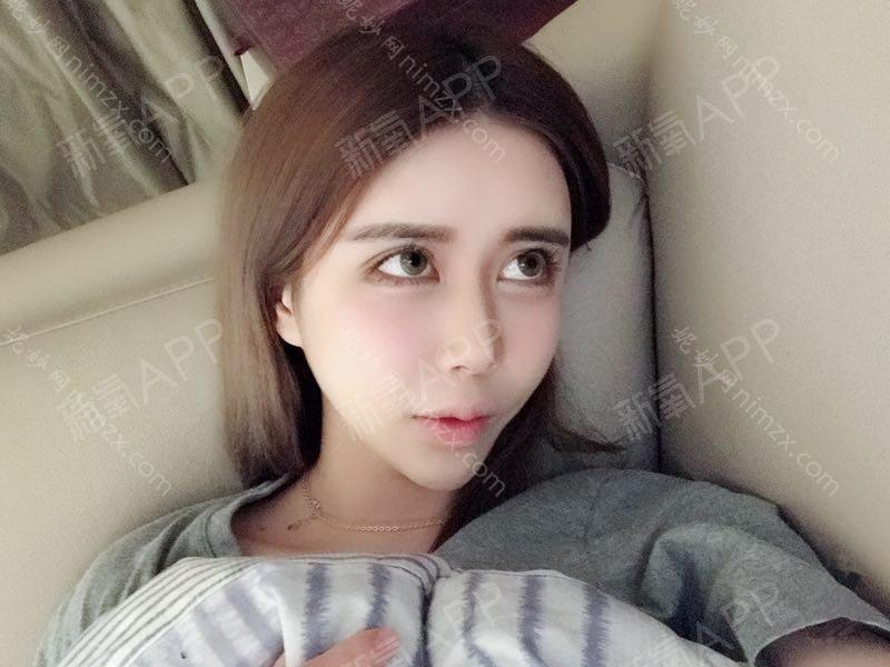 广东哪家医院做玻尿酸丰鼻基底比较靠谱？排行榜大全上榜牙科依次公布!含口碑及价格明细！