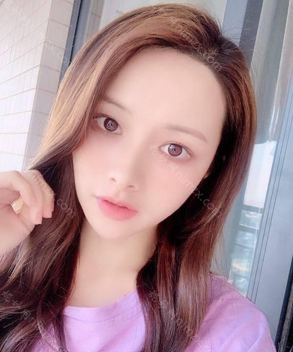 广东哪家医院做去黑眼圈效果比价好？盘点前三排行榜!中南、广大微创、艾睿雅都在内!！