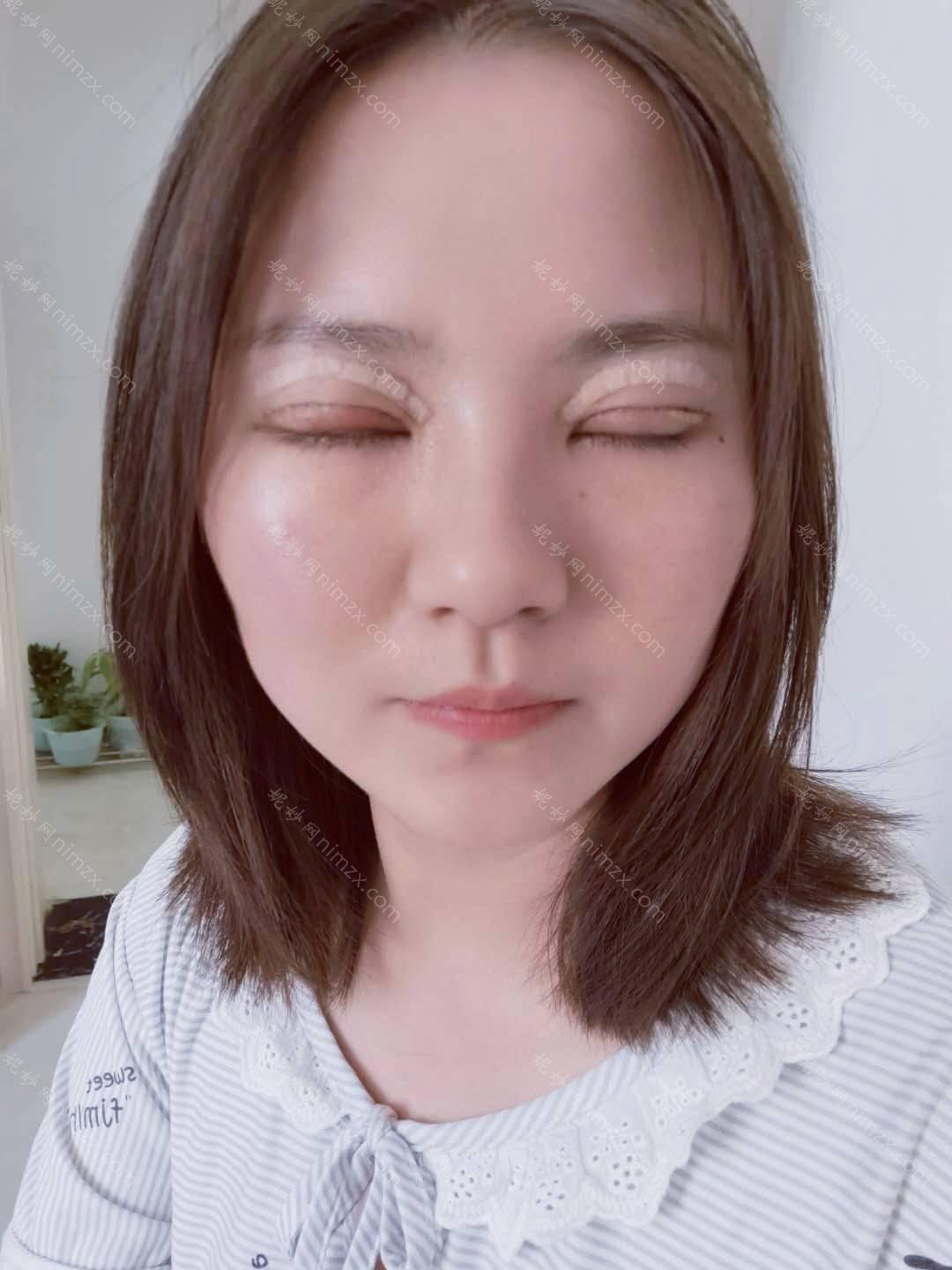 广东哪家医院做去黑眼圈效果比价好？盘点前三排行榜!中南、广大微创、艾睿雅都在内!！