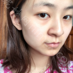天津哪家医院做丰苹果肌好看？排行名单有星和、和平薇什、韩美等!价格收费均价一览!！