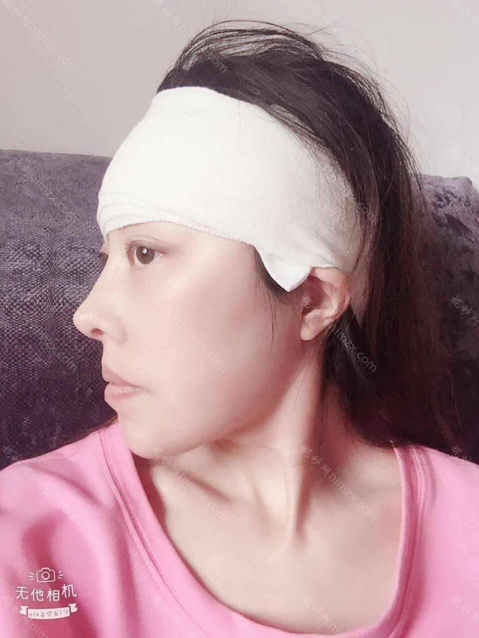 天津哪家医院做丰太阳穴手术较好？排名前十强口碑亮眼~送上案例及价格表做比较！