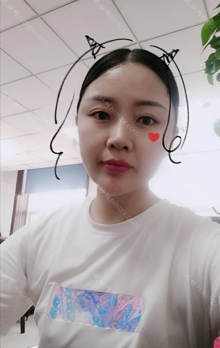 天津哪家医院做丰太阳穴手术较好？排名前十强口碑亮眼~送上案例及价格表做比较！