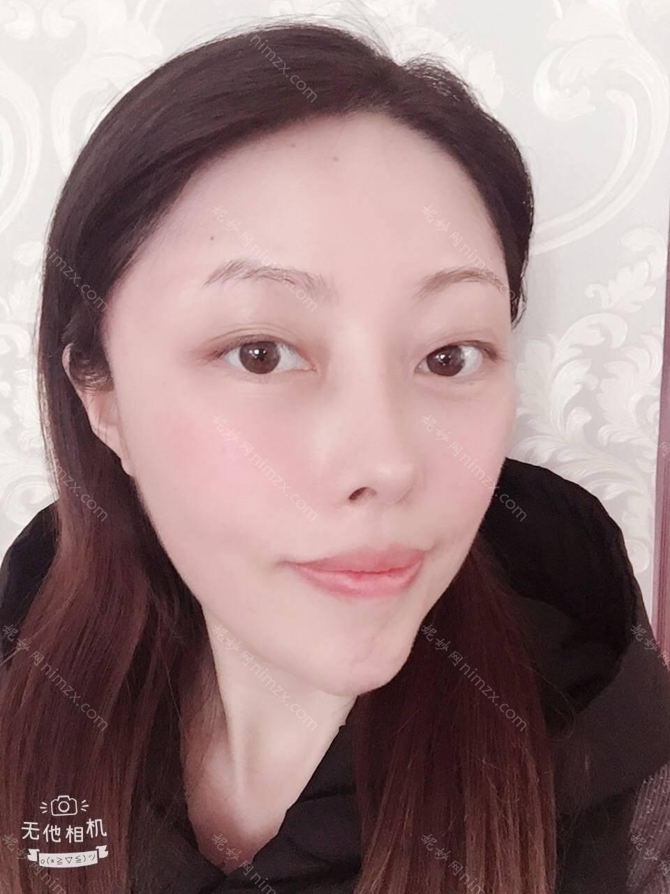 天津哪家医院做丰太阳穴手术较好？排名前十强口碑亮眼~送上案例及价格表做比较！