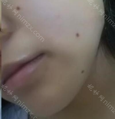 云南华美美莱美容医院曹国靖医生怎么样