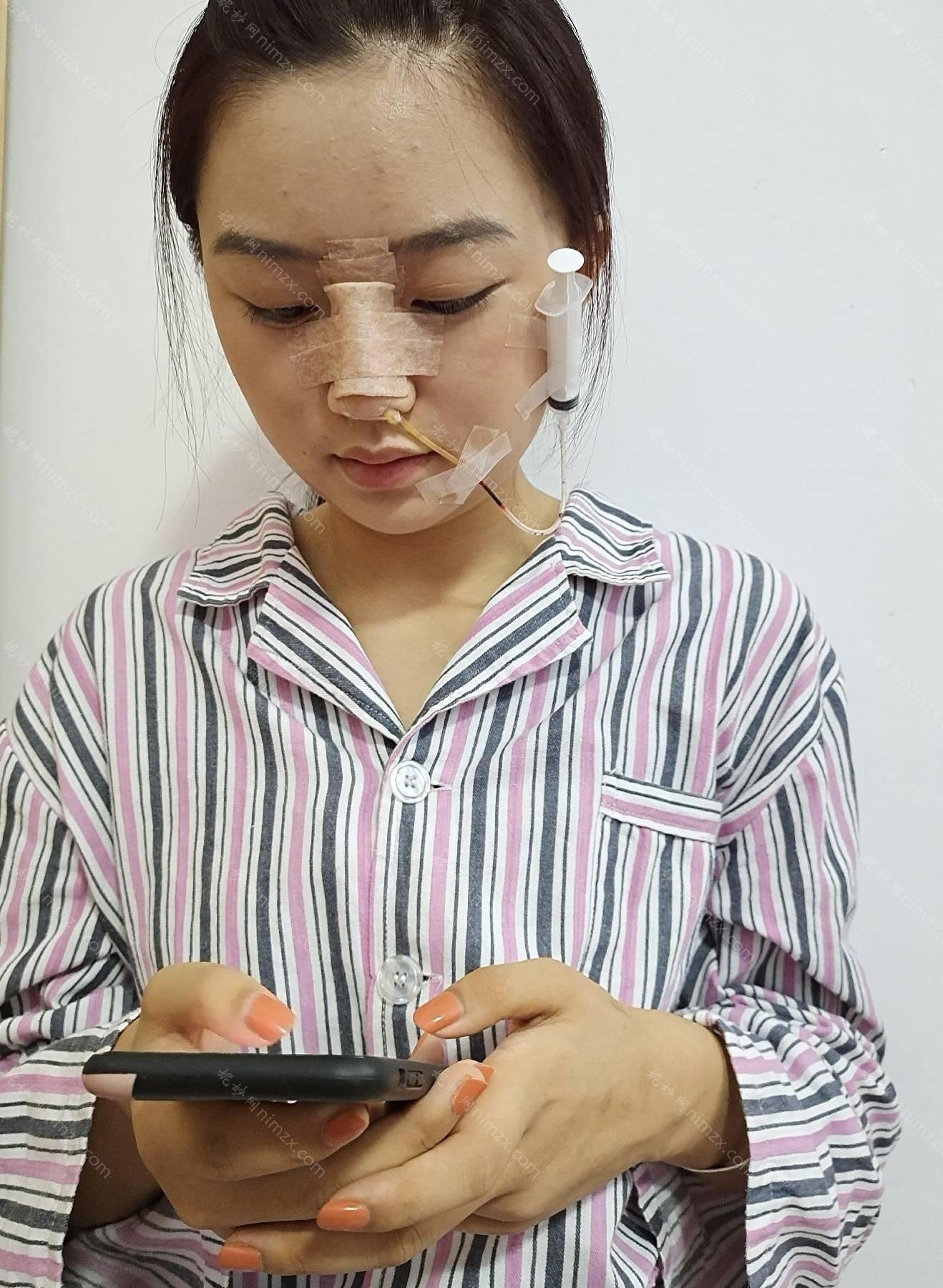 广东哪家医院做鼻综合整形效果好？排名前三澳玛星光、曙光、大来都有资质_专家实力不浅!！