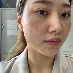 广东哪家医院做眶隔释放去眼袋手术较好？排行榜医院齐聚_臻希美、名优等一一公布口碑!！