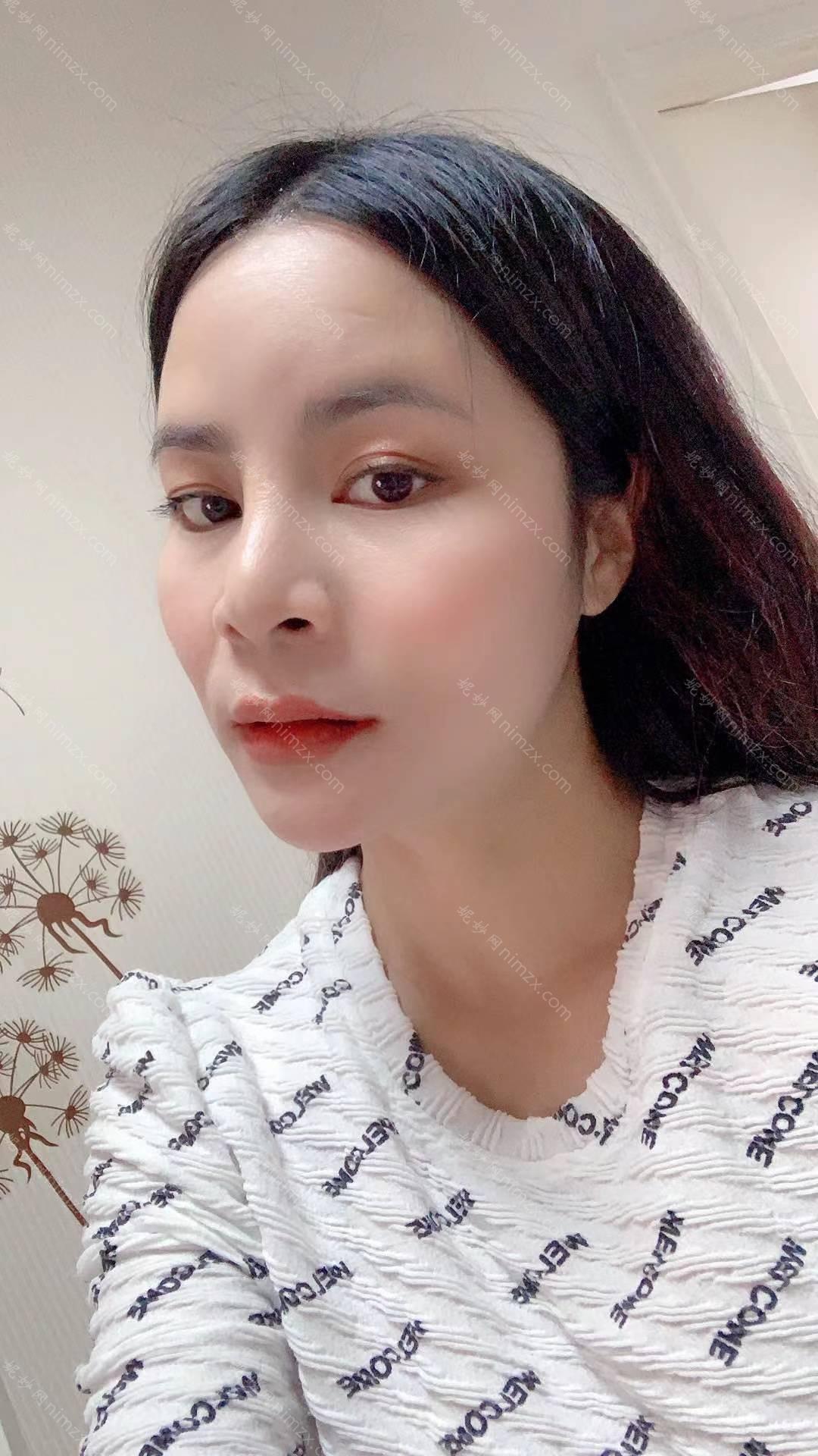 广东哪家医院做垫鼻基底效果好？这几家预约量高口碑好_价格透明！