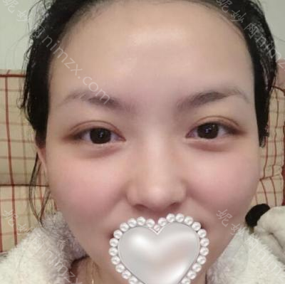 昆明梦想医疗美容医院杜茂华医生怎么样