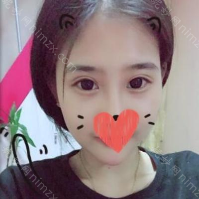 昆明梦想医疗美容整形医院整形林清医生怎么样