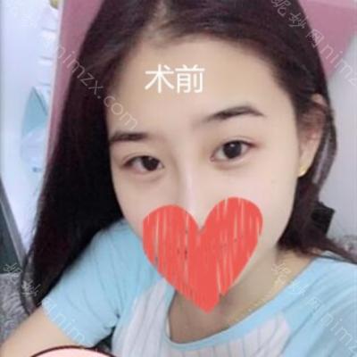 昆明梦想医疗美容整形医院整形林清医生怎么样
