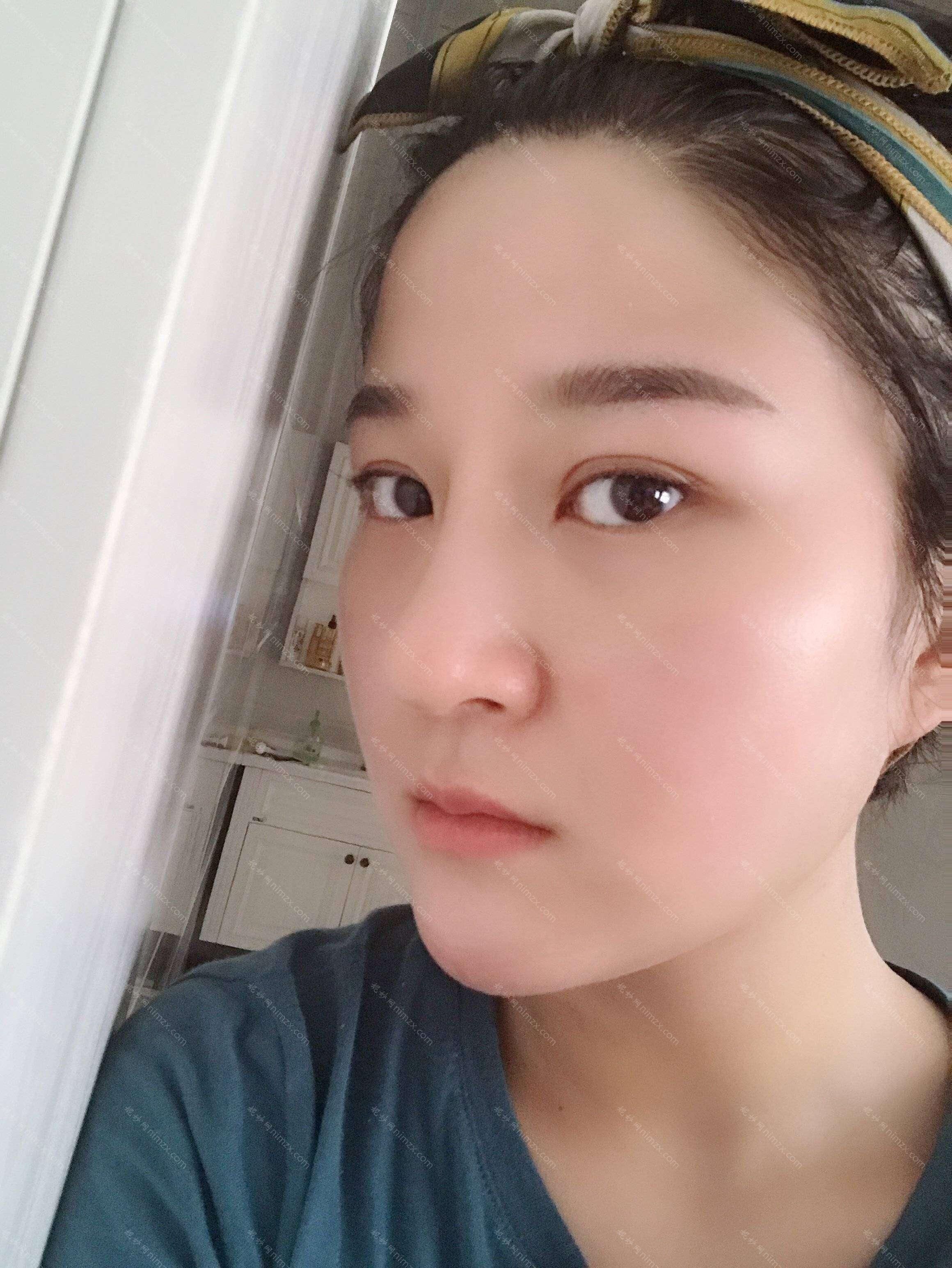 广东哪家医院做鼻中隔软骨隆鼻好？2021排行榜前五这几家都有资质_含婕熹卡、佛山中西医结合医院等医院！