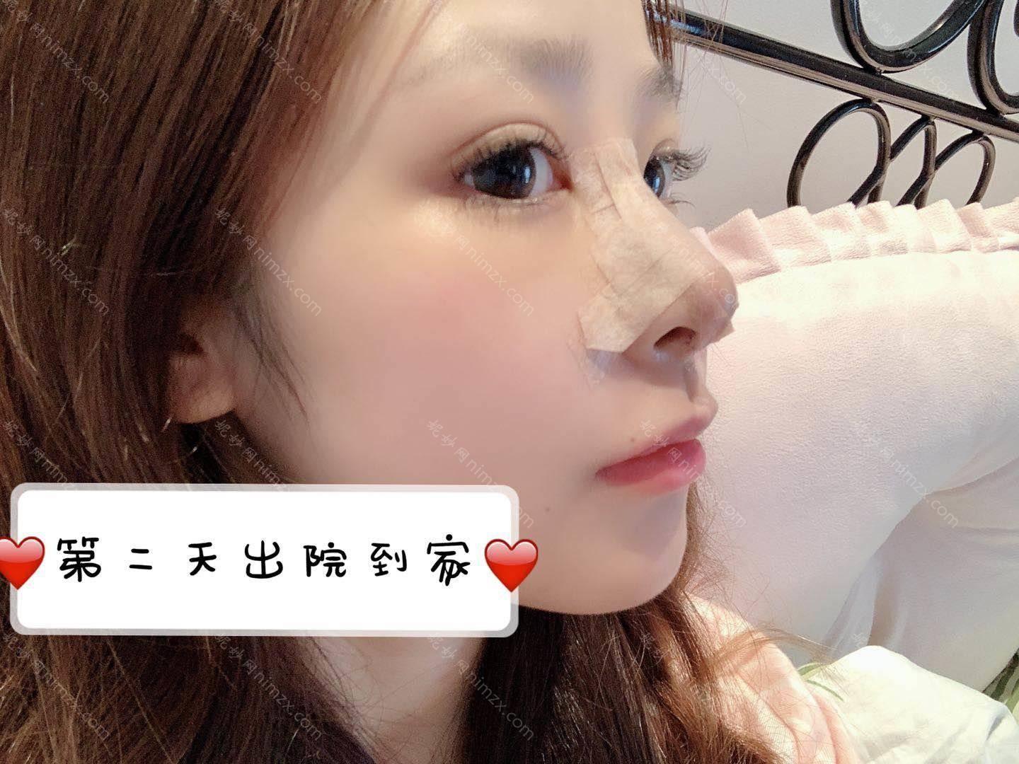 广东哪家医院做鼻中隔软骨隆鼻好？2021排行榜前五这几家都有资质_含婕熹卡、佛山中西医结合医院等医院！