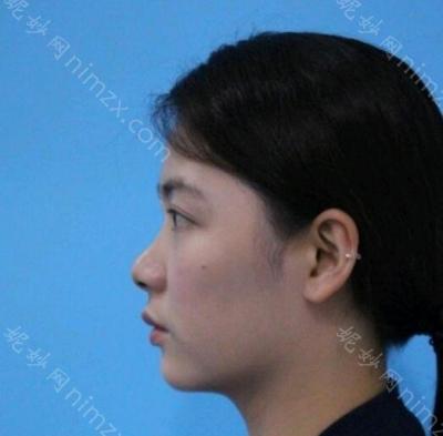 云南华美美莱美容医院黄景华医生怎么样