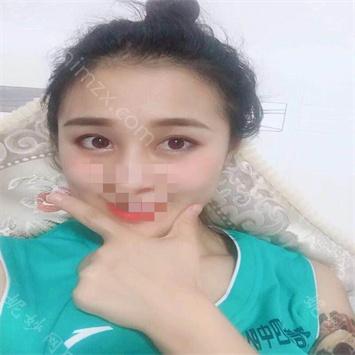 昆明艺星医疗美容医院尹建兰医生怎么样