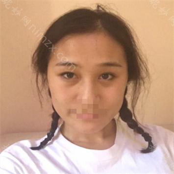 昆明艺星医疗美容医院尹建兰医生怎么样