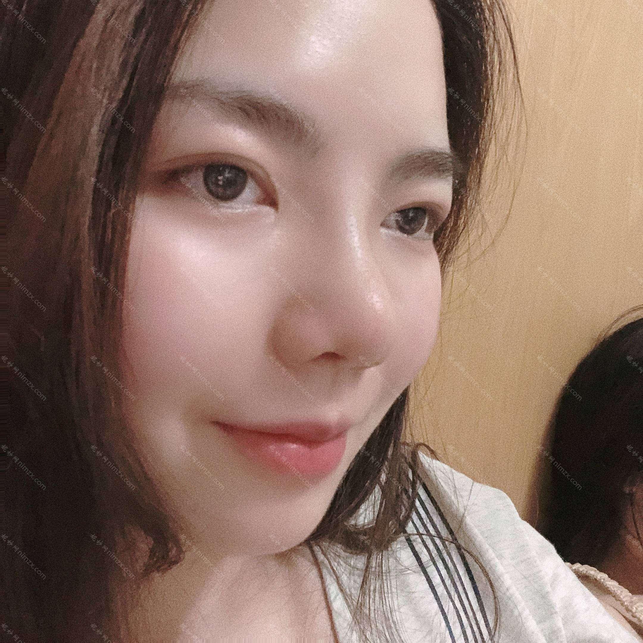 广东哪家医院做超体隆鼻正规？当属炫美、南方医科大学附属何贤纪念医院、药科大学附属第三医院皮肤疤痕科这三家!价格(案例)盘