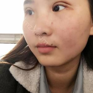广东哪家医院做肿泡眼双眼皮效果比价好？排行榜大全上榜牙科依次公布!含口碑及价格明细！