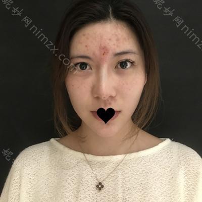云南华美美莱美容医院美莱黄梦婷医生怎么样