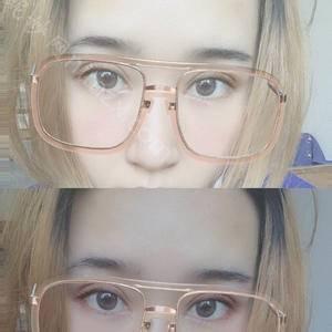 广东哪家医院做切开法双眼皮比较好？排行名单有壹美健、南海区长安较好人民医院-、艾美等!价格收费均价一览!！