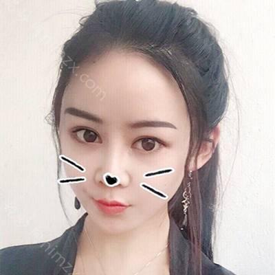 天津哪家医院做颌骨整形正规？医美4强全新阵容一一介绍_整形价格查询！