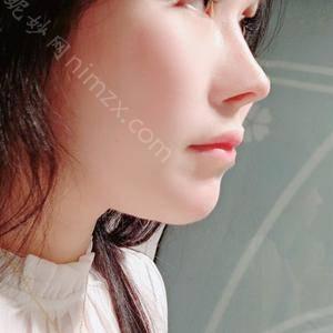 天津哪家医院做颌骨整形正规？医美4强全新阵容一一介绍_整形价格查询！