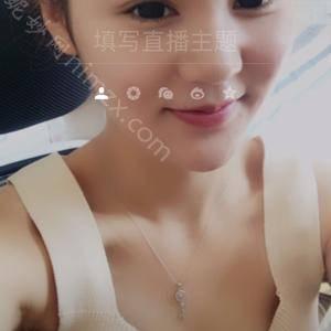 广东哪家医院做韩式三点双眼皮手术好？排名前四权威医美口碑盘点_含手术价格查询！