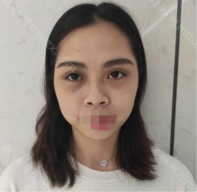 云南华美美莱美容医院朱虹医生怎么样