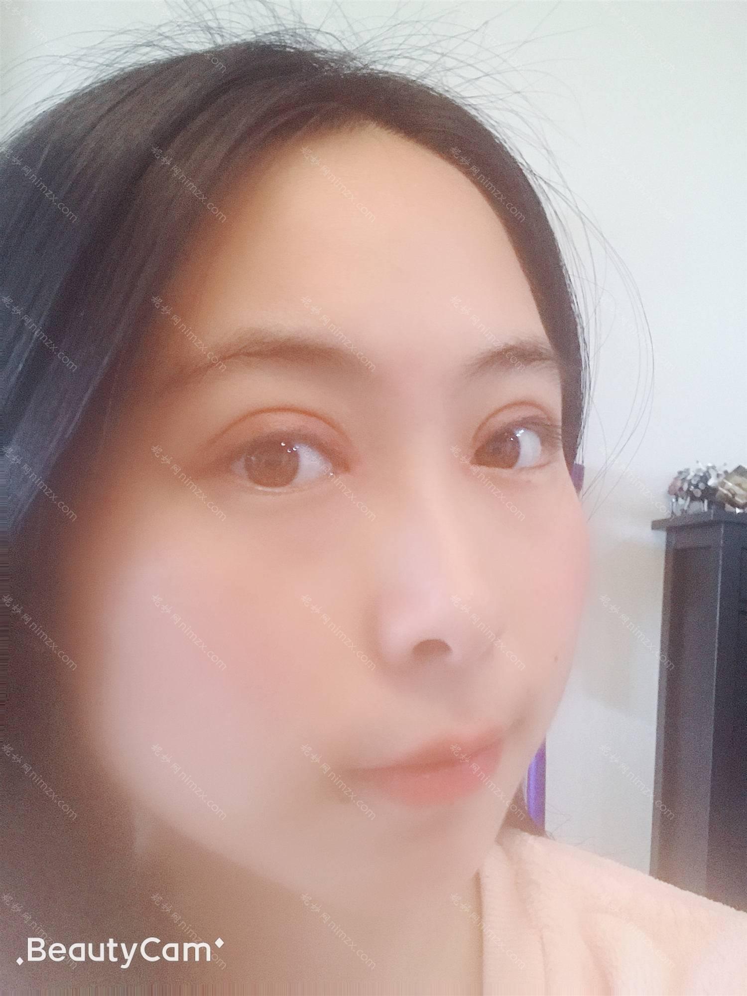 天津哪家医院做丰下巴比较好？排名前五口碑医院盘点_天津市公安医院、红桥科发源实力入围！