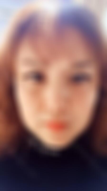 依萱绮医学美容蔡震医生做上眼睑去脂 靠谱吗？