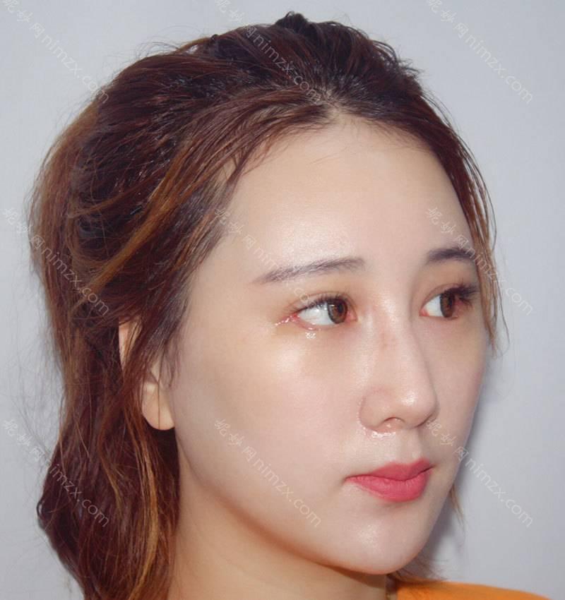 河北哪家医院做下睑下至效果比价好？全国排名前五医院来对比!价格(多少钱)参考！
