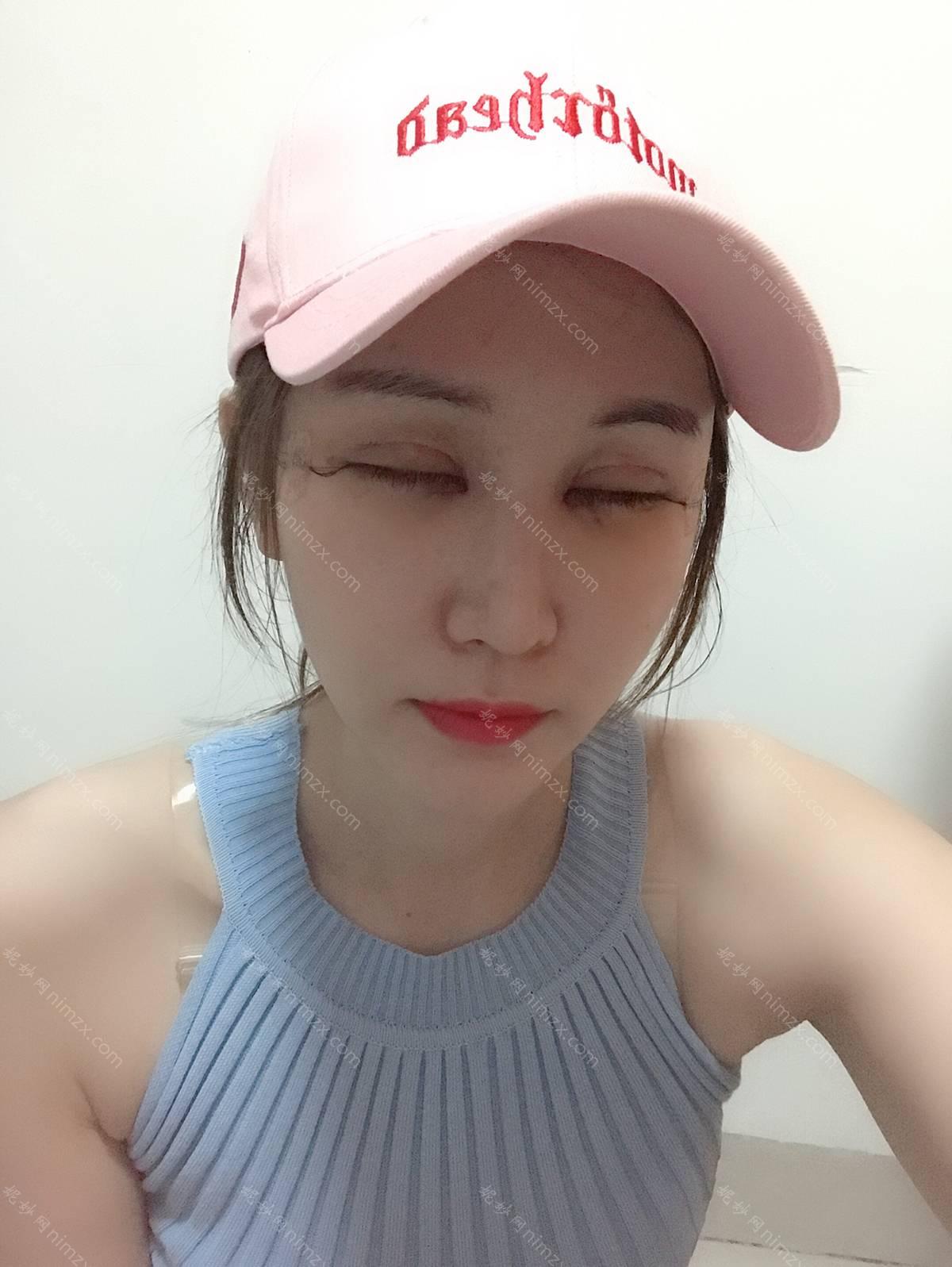 河北哪家医院做下睑下至效果比价好？全国排名前五医院来对比!价格(多少钱)参考！