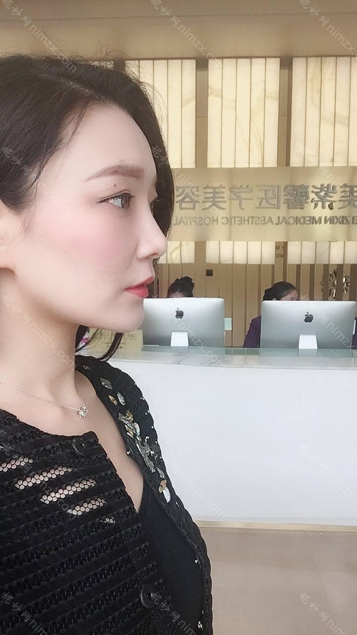 通化泰自然医疗美容温泉SPa李菲柯做胶原蛋白隆鼻怎么样？附医生简介|胶原蛋白隆鼻案例及价格表