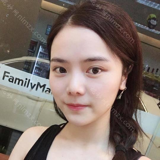 景德镇哪家医院做全切双眼皮好看？排名前四权威医美口碑盘点_含手术价格查询！