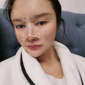 肇庆哪家医院做软肋骨隆鼻好？全国排名前五医院来对比!价格(多少钱)参考！
