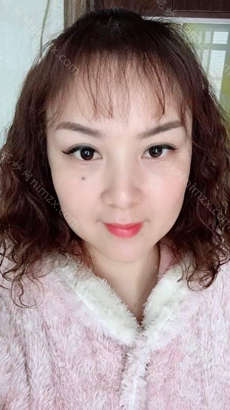依萱绮医学美容蔡震医生做上眼睑去脂 靠谱吗？