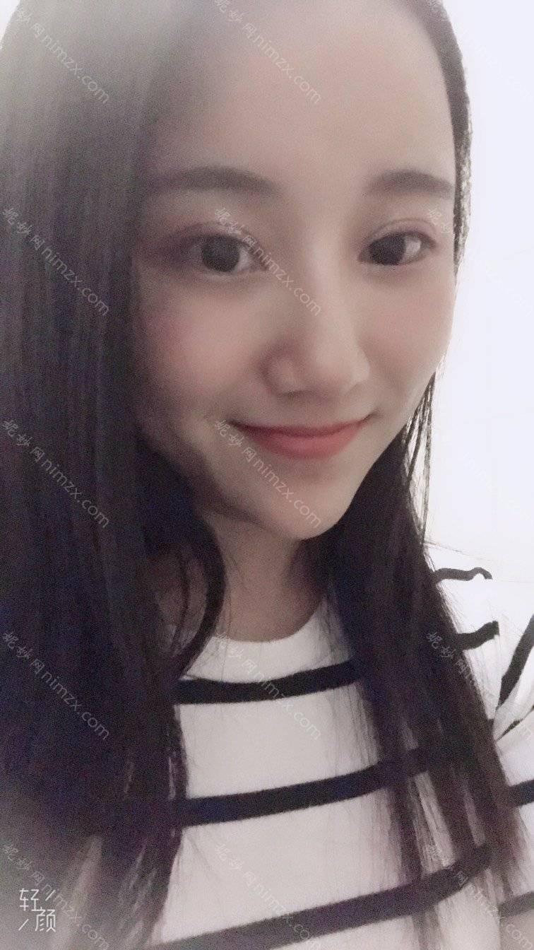 依萱绮医学美容卢帆医生做面部提升怎么样？