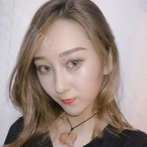 依萱绮医学美容傅荣医生做去雀斑技术怎么样？