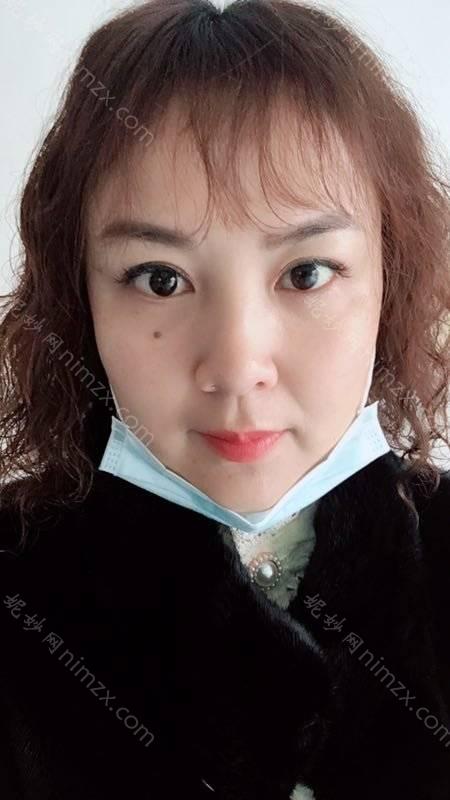 四川省人民医院整形美容科游晓波医生做开眼角修复 靠谱吗？