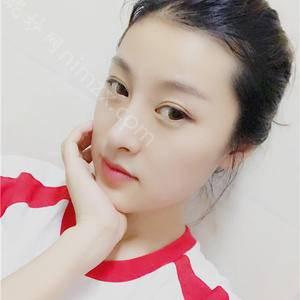 长沙爱思特整形医疗美容医院彭远清医生做开眼角修复好吗？