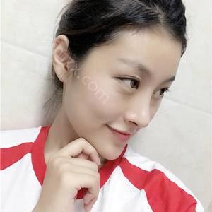 长沙爱思特整形医疗美容医院彭远清医生做开眼角修复好吗？