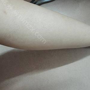 北京协和医院整形外科比基尼脱毛靠谱吗？比基尼脱毛案例、各项价格标准公示,附医院各项整容价格表
